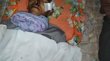 Gegerr….!” Suparno Tewas Ditemb4ki Sidik 5 Titik Luka Bekas Timah Senapang Bersarang Ditubuh Korban